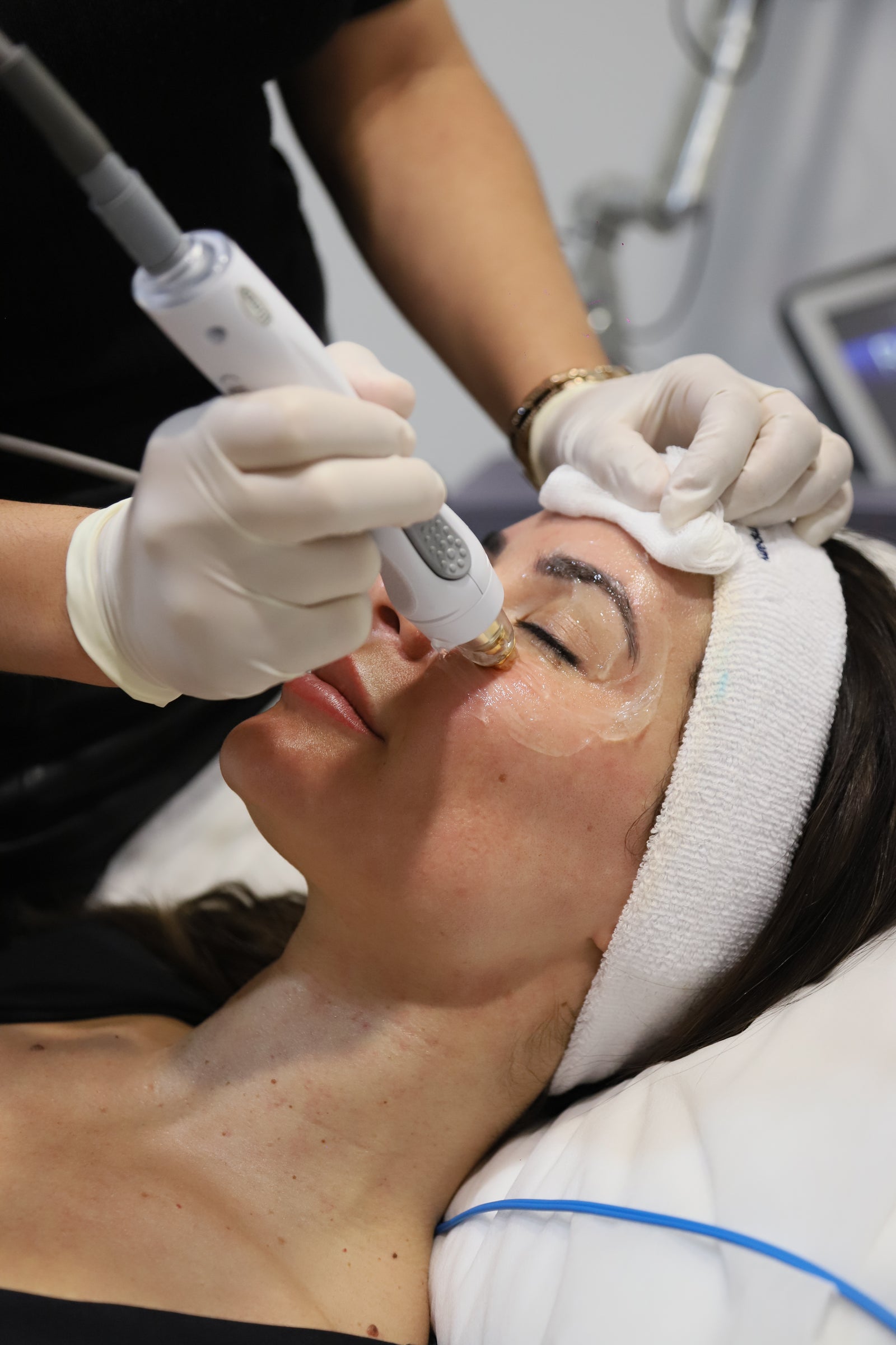 Skin needling post-facial at Sydney's Ilumaé Skin Bar