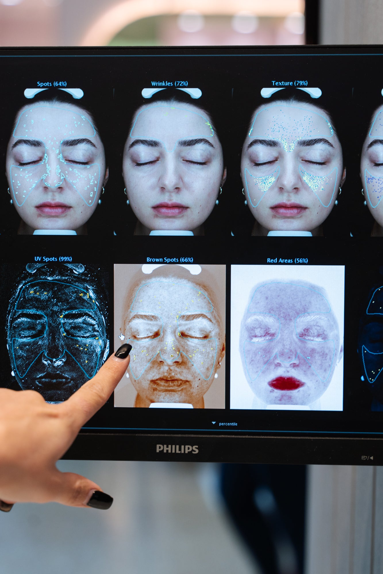 3D skin analysis for Sydney's best facial at Ilumaé Skin Bar