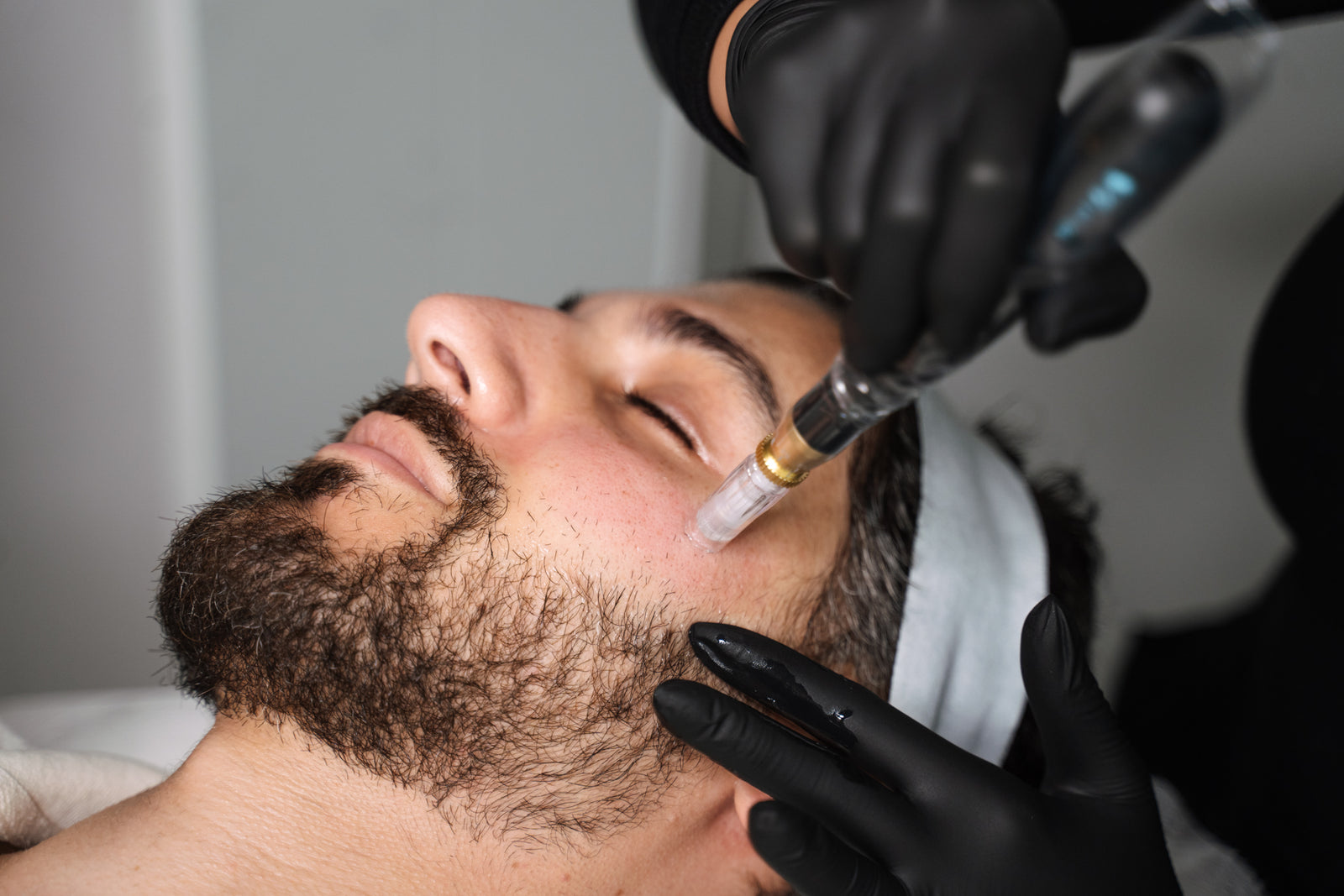Men's facial and skin needling at Sydney's Ilumaé Skin Bar